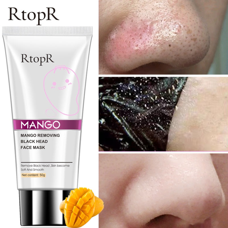 Mango Blackhead Remover Acne Treatment